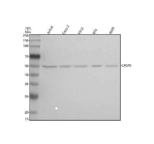 Anti-Caspase-8 CASP8 Rabbit Monoclonal Antibody Boster Bio