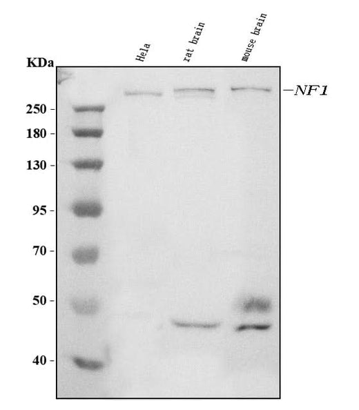 Anti-Neurofibromin/NF1 Antibody Picoband® (monoclonal, 4C6F10 Boster Bio