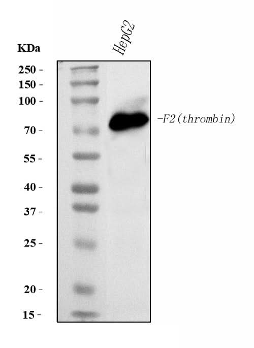 Anti-Prothrombin Antibody Picoband® (monoclonal, 4G13G9 Boster Bio