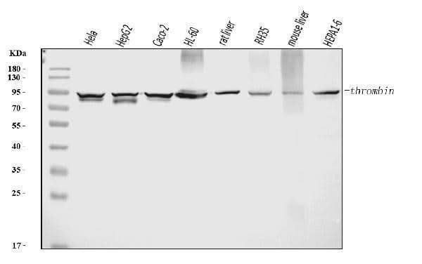 Anti-Prothrombin Antibody Picoband® (monoclonal, 5B6G1 Boster Bio