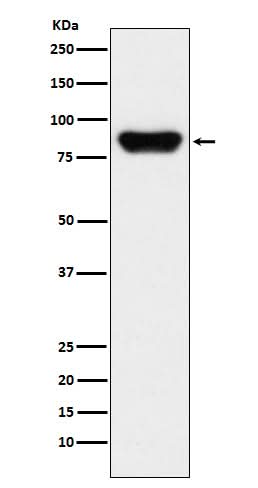 Anti-Prothrombin F2 Monoclonal Antibody Boster Bio