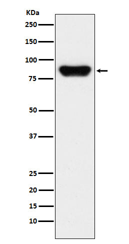 Anti-Prothrombin F2 Monoclonal Antibody Boster Bio