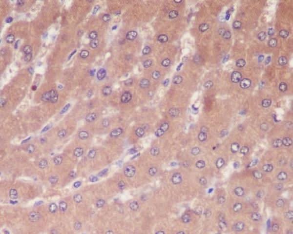 Anti-Caspase-1 CASP1 Rabbit Monoclonal Antibody Boster Bio