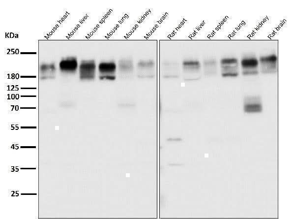 Anti-P Glycoprotein ABCB1 Rabbit Monoclonal Antibody Boster Bio