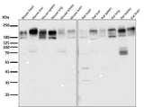 Anti-P Glycoprotein ABCB1 Rabbit Monoclonal Antibody Boster Bio