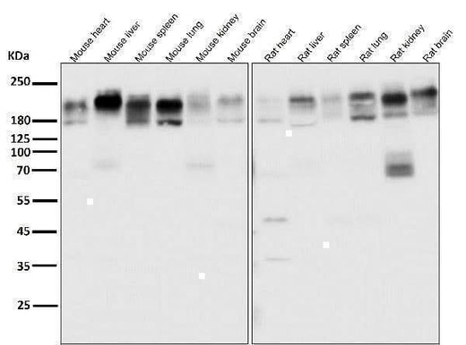 Anti-P Glycoprotein ABCB1 Rabbit Monoclonal Antibody Boster Bio