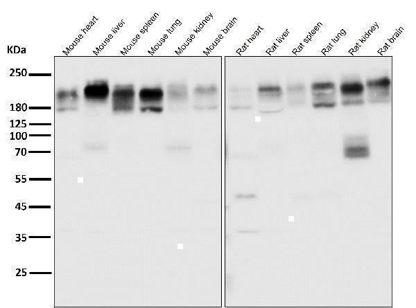 Anti-P Glycoprotein ABCB1 Rabbit Monoclonal Antibody Boster Bio