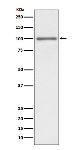 Anti-KMT6 / EZH2 Rabbit Monoclonal Antibody Boster Bio