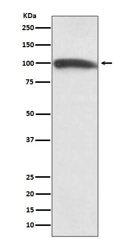 Anti-KMT6 / EZH2 Rabbit Monoclonal Antibody Boster Bio