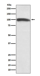 Anti-KMT6 / EZH2 Rabbit Monoclonal Antibody Boster Bio