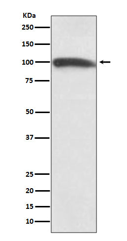Anti-KMT6 / EZH2 Rabbit Monoclonal Antibody Boster Bio