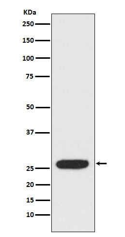 Anti-StAR Rabbit Monoclonal Antibody Boster Bio
