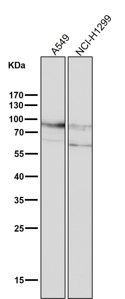 Anti-CD44 Rabbit Monoclonal Antibody Boster Bio