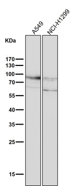 Anti-CD44 Rabbit Monoclonal Antibody Boster Bio