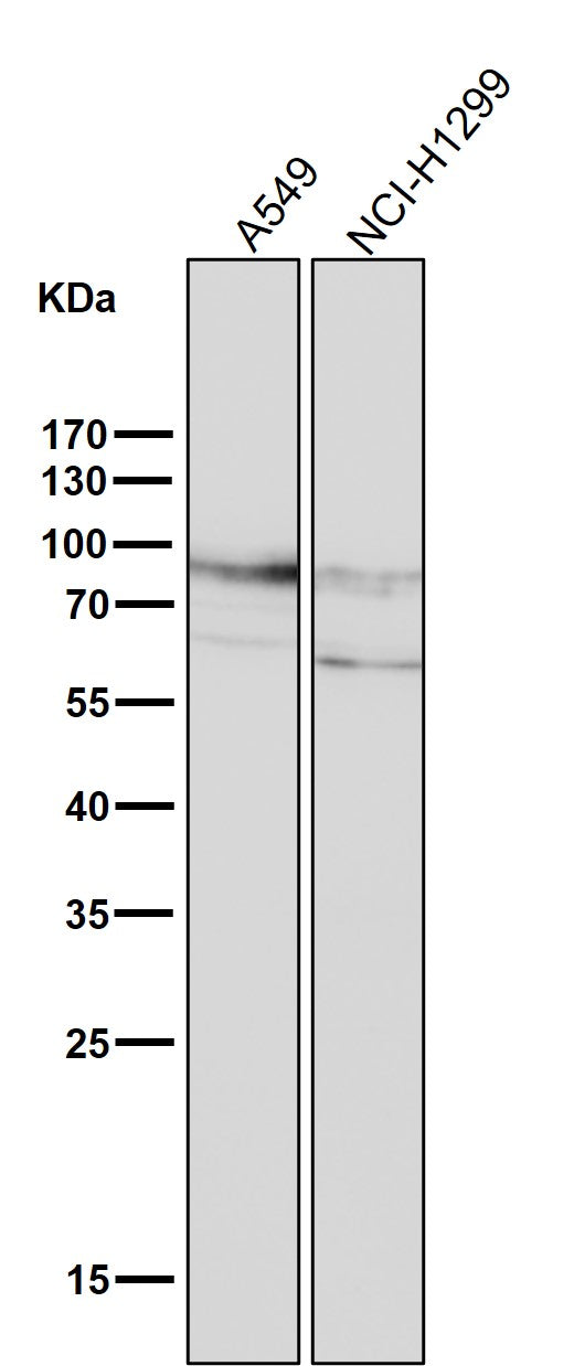 Anti-CD44 Rabbit Monoclonal Antibody Boster Bio
