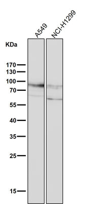 Anti-CD44 Rabbit Monoclonal Antibody Boster Bio