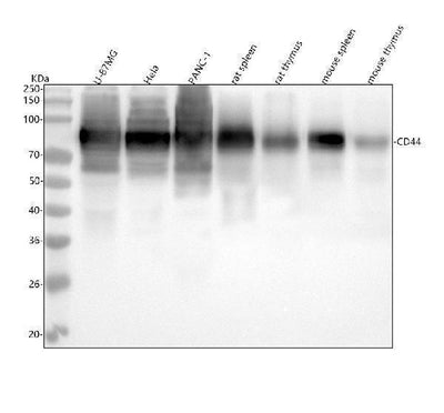 Anti-CD44 Rabbit Monoclonal Antibody Boster Bio