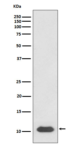 Anti-SDF1 CXCL12 Rabbit Monoclonal Antibody Boster Bio