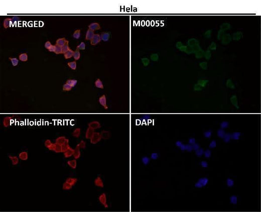 Anti-Fas/Cd95 Rabbit Monoclonal Antibody Boster Bio