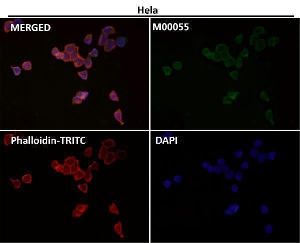 Anti-Fas/Cd95 Rabbit Monoclonal Antibody Boster Bio