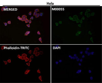 Anti-Fas/Cd95 Rabbit Monoclonal Antibody Boster Bio