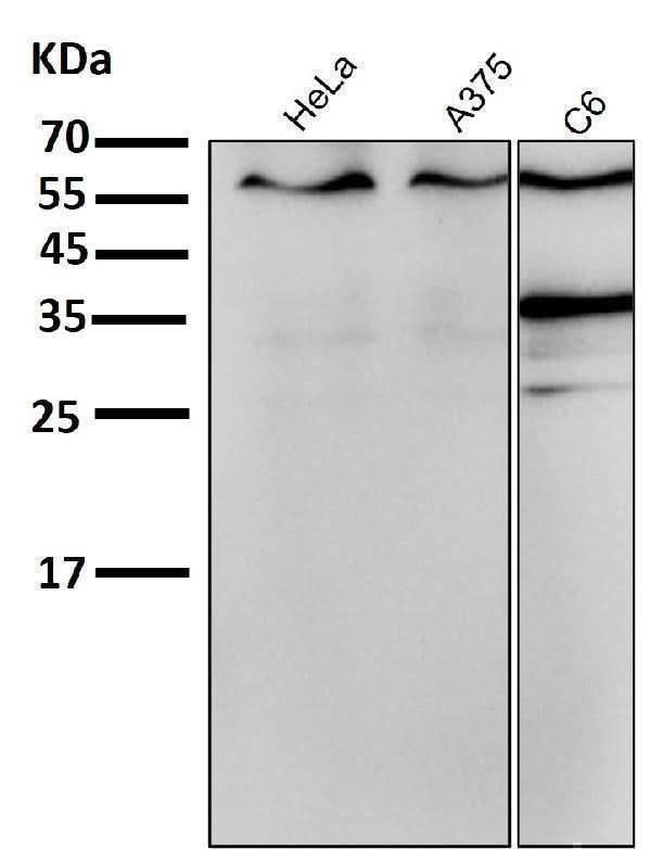 Anti-ER alpha ESR1 Rabbit Monoclonal Antibody Boster Bio
