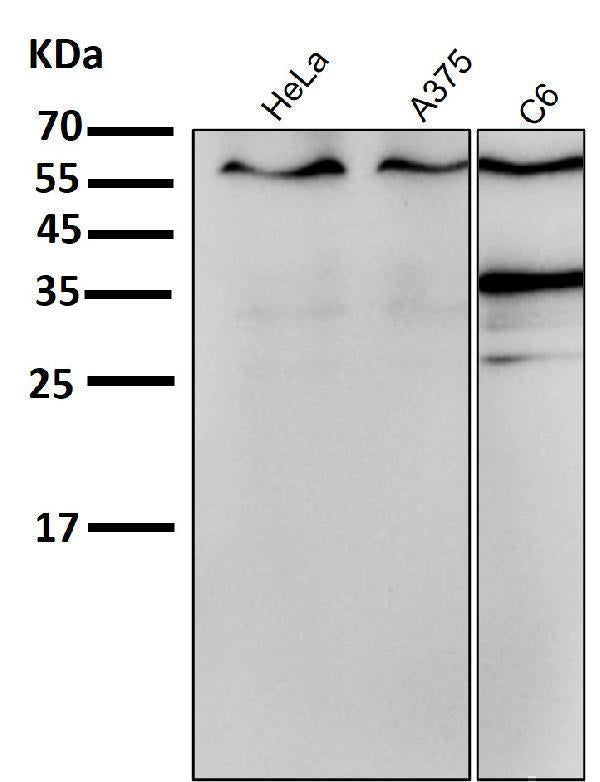 Anti-ER alpha ESR1 Rabbit Monoclonal Antibody Boster Bio
