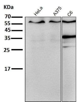 Anti-ER alpha ESR1 Rabbit Monoclonal Antibody Boster Bio