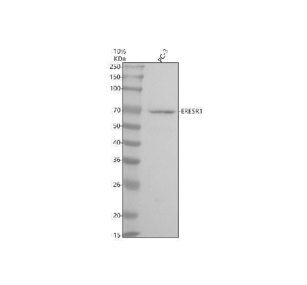 Anti-Estrogen Receptor alpha Rabbit Monoclonal Antibody Boster Bio