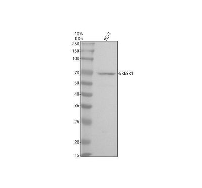 Anti-Estrogen Receptor alpha Rabbit Monoclonal Antibody Boster Bio