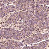 Anti-Smad3 Rabbit Monoclonal Antibody Boster Bio
