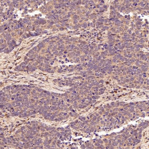 Anti-Smad3 Rabbit Monoclonal Antibody Boster Bio