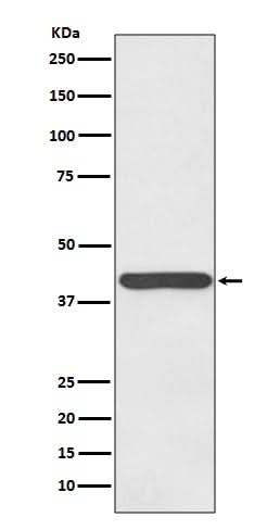 Anti-Haptoglobin HP Rabbit Monoclonal Antibody Boster Bio