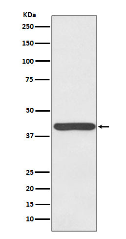 Anti-Haptoglobin HP Rabbit Monoclonal Antibody Boster Bio