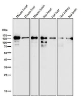 Anti-pan Cadherin 1 CDH1 Rabbit Monoclonal Antibody Boster Bio