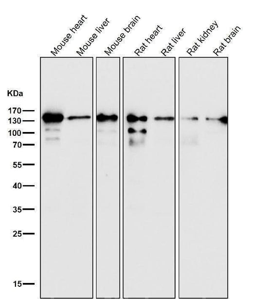Anti-pan Cadherin 1 CDH1 Rabbit Monoclonal Antibody Boster Bio
