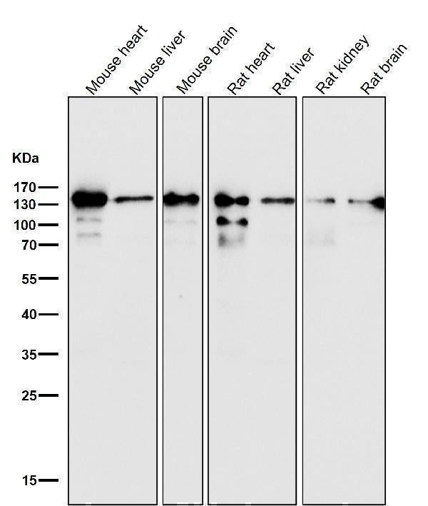 Anti-pan Cadherin 1 CDH1 Rabbit Monoclonal Antibody Boster Bio