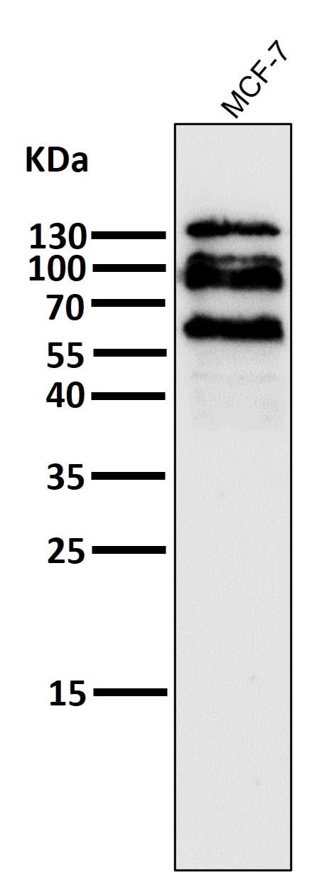 Anti-E Cadherin Rabbit Monoclonal Antibody Boster Bio