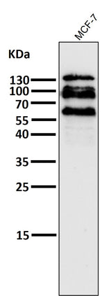 Anti-E Cadherin Rabbit Monoclonal Antibody Boster Bio