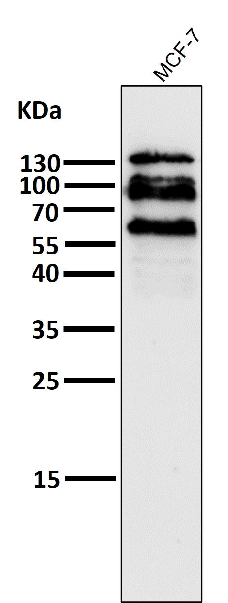 Anti-E Cadherin Rabbit Monoclonal Antibody Boster Bio
