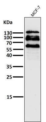 Anti-E Cadherin Rabbit Monoclonal Antibody Boster Bio