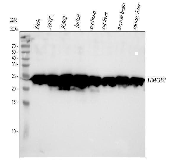 Anti-HMGB1/Hmg 1 Rabbit Monoclonal Antibody Boster Bio