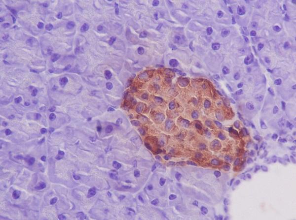 Anti-Insulin Rabbit Monoclonal Antibody Boster Bio