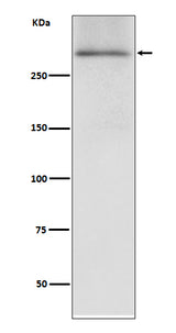Anti-Dystrophin DMD Rabbit Monoclonal Antibody Boster Bio