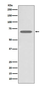 Anti-beta 2 Adrenergic Receptor ADRB2 Rabbit Monoclonal Antibody Boster Bio