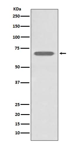 Anti-beta 2 Adrenergic Receptor ADRB2 Rabbit Monoclonal Antibody Boster Bio