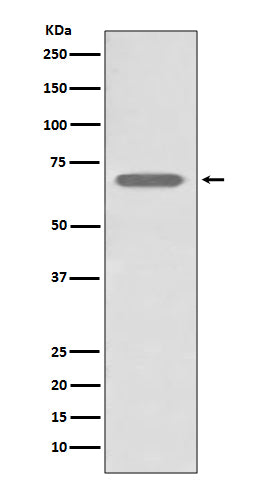 Anti-beta 2 Adrenergic Receptor ADRB2 Rabbit Monoclonal Antibody Boster Bio