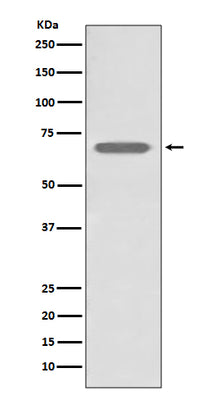 Anti-beta 2 Adrenergic Receptor ADRB2 Rabbit Monoclonal Antibody Boster Bio