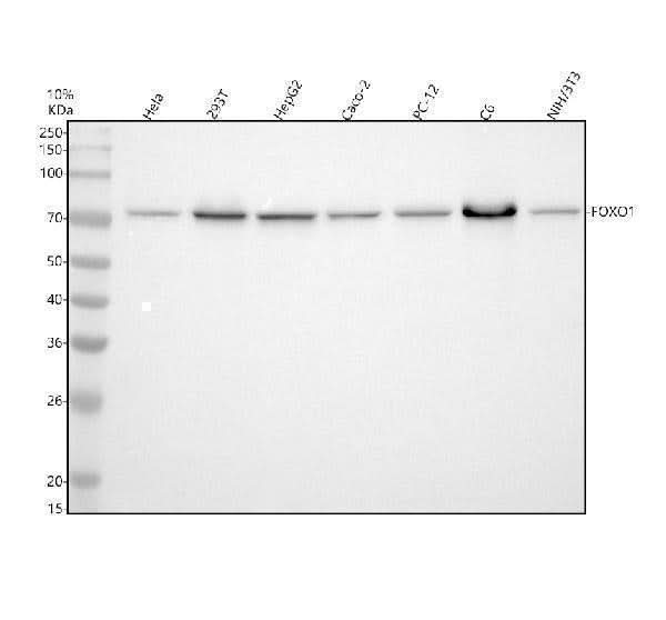Anti-FOXO1 Rabbit Monoclonal Antibody Boster Bio