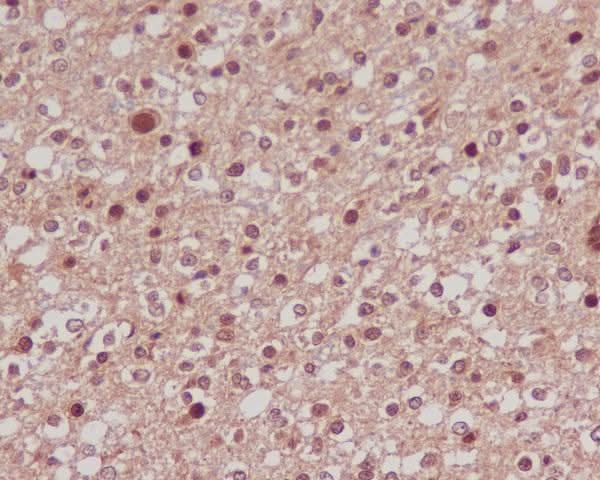Anti-FoxO1a Rabbit Monoclonal Antibody Boster Bio